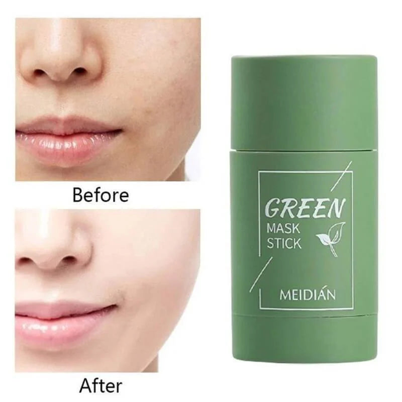 Green Mask Stick ™ | Laatste dag 1+1 GRATIS